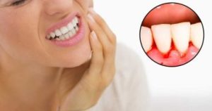 علامات تكشف بها عن مدى سلامة اللثة لديك.. وأخرى تحذرك من أمراضها