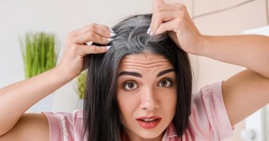 7 وصفات طبيعية تساعد على إخفاء الشعر الأبيض دون صبغة