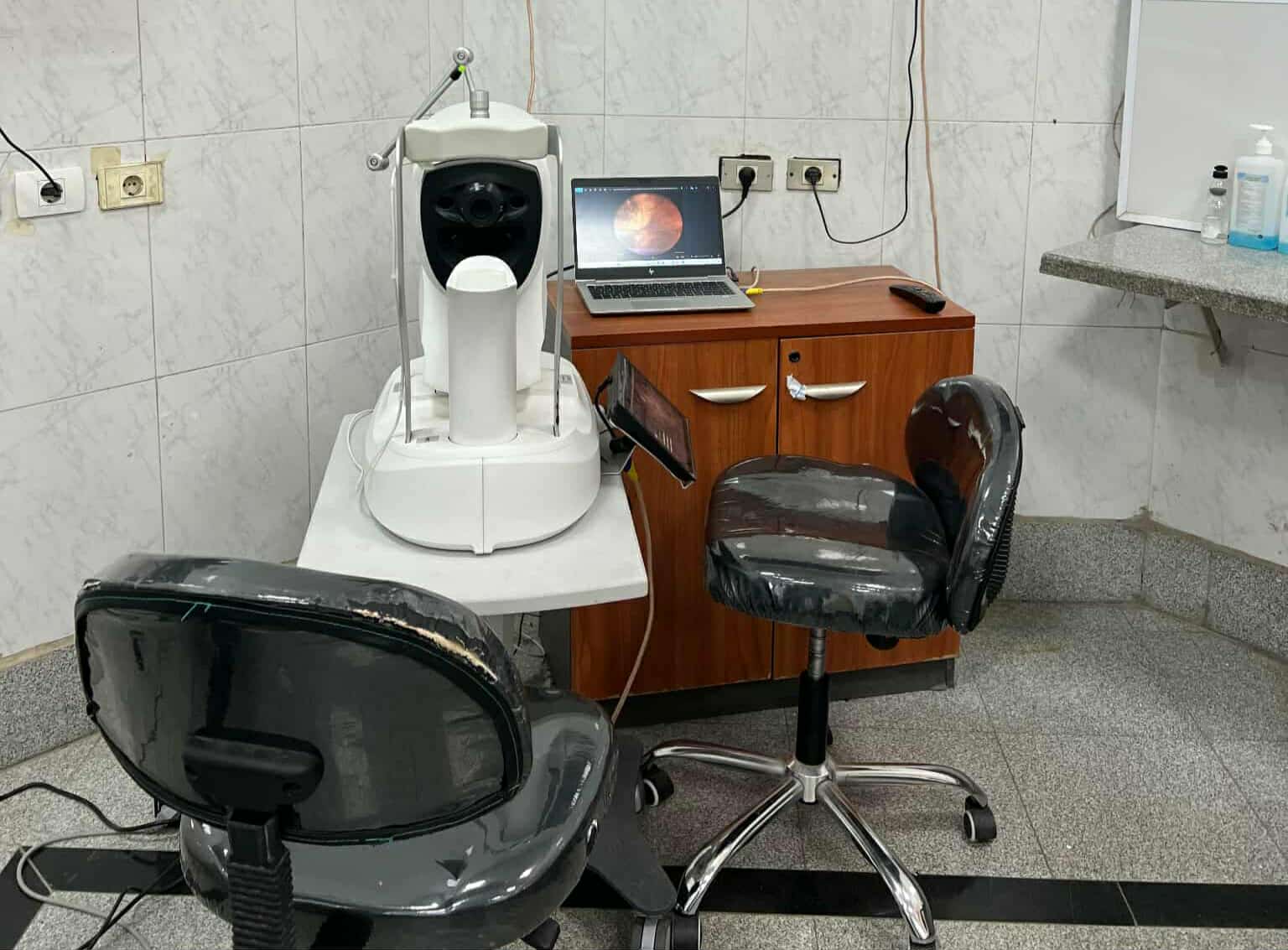 وحدة أورام العيون بقصر العيني: فحص 1500 مريض والاشتباه في 550 خلال 3 سنوات