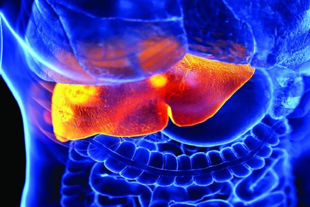 فحص دم بسيط يكشف “القاتل الصامت” قبل عقد من الزمن