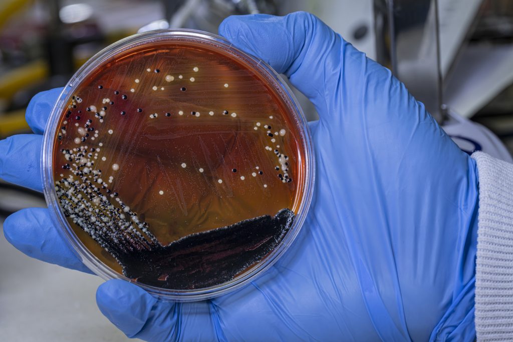 Une bactérie humaine défie l’espace et survit aux conditions les plus extrêmes !