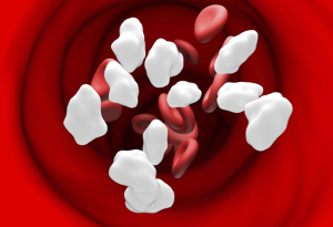 Signe d'Alerte Important pour l'Hyperglycémie