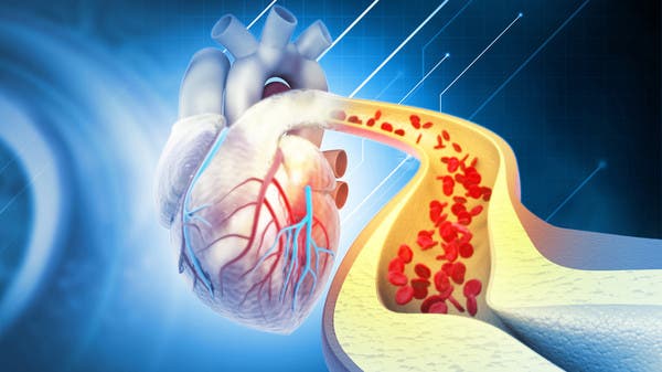 5 أطعمة تُنظّف الشرايين وتُحسّن الدورة الدموية