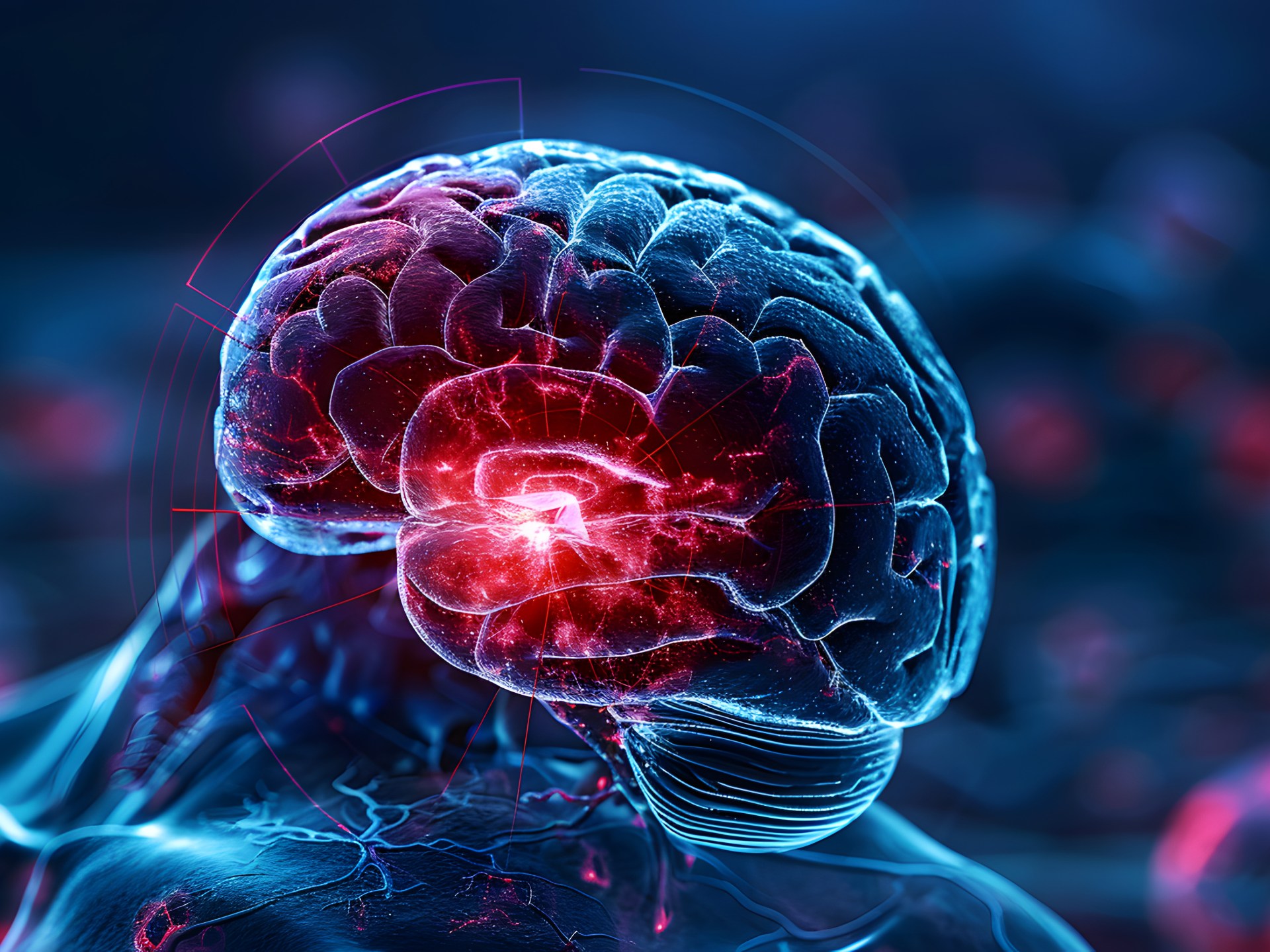 Étude : Le glioblastome ne se limite pas au cerveau