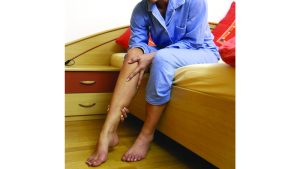 Les longs trajets et le manque de mouvement, principales causes de la "thrombose"